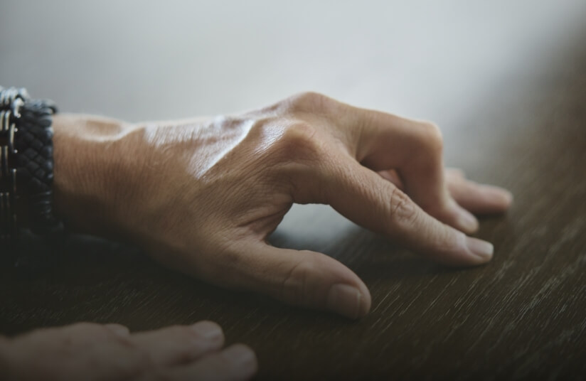 Thumbnail for a video called Brad On Surgery, showing a hand with Dupuytren's contracture unable to lay flat on a table